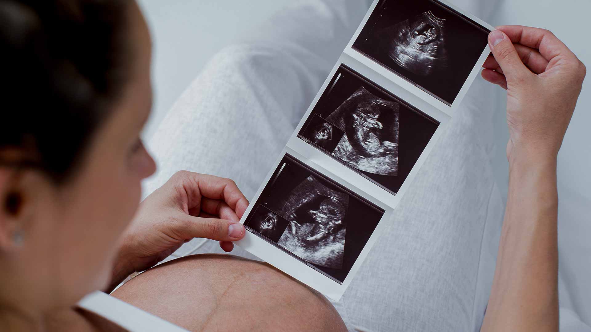 ABSA-adoption-plan